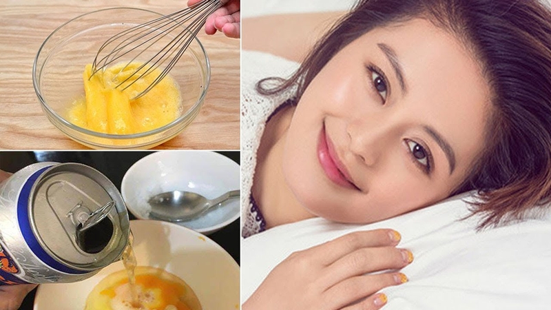 trị tóc gàu mảng 3