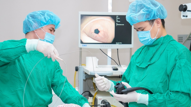 Nội soi tiêu hóa trên: Quy trình thực hiện và điều cần chú ý 2
