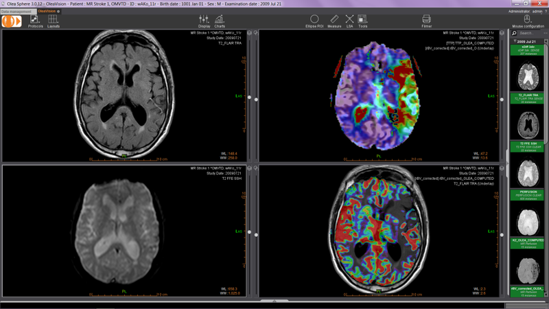 cac-hinh-anh-chan-thuong-so-nao-2