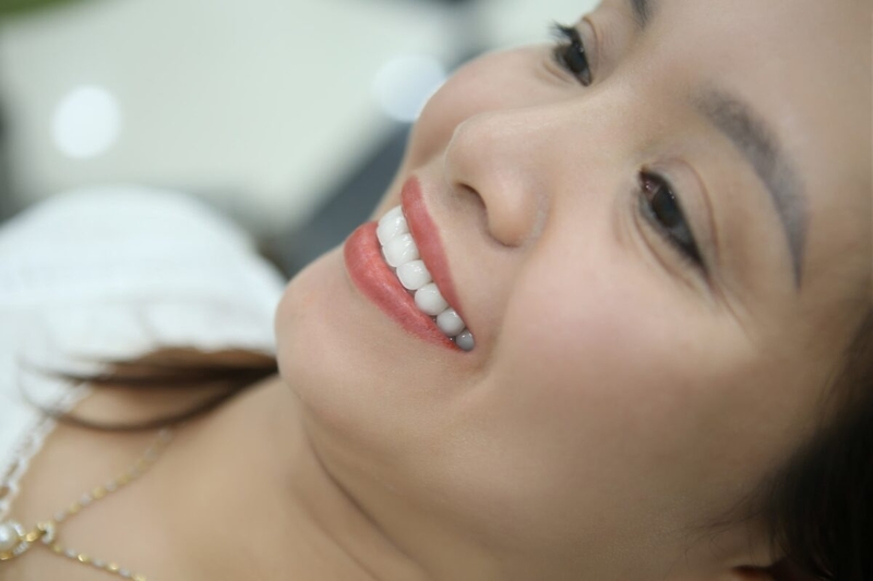 Răng sứ Orodent là gì? Khi nào cần bọc răng sứ? 1