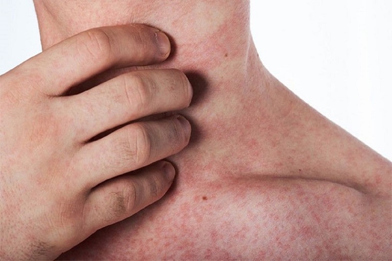 Panadol xanh có gây buồn ngủ không? Những tác dụng của Panadol 3