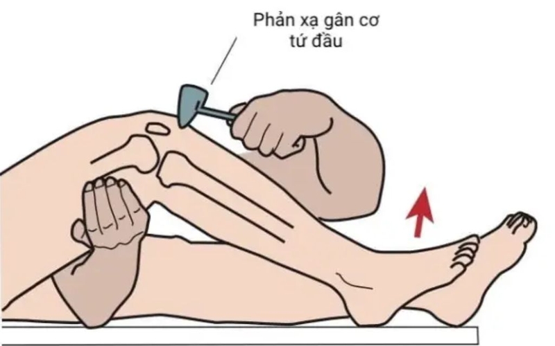 Phản xạ gân xương là gì? Phương pháp kiểm tra và yếu tố tác động 3