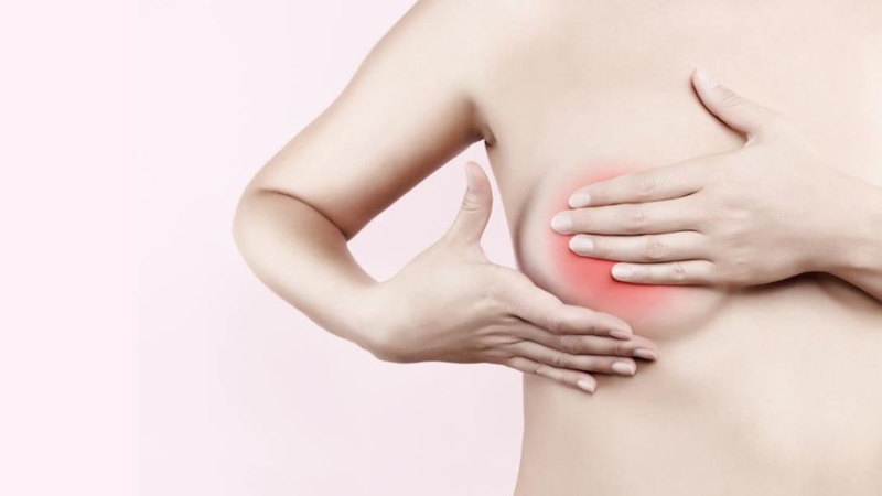 Phì đại tuyến vú 4.jpg