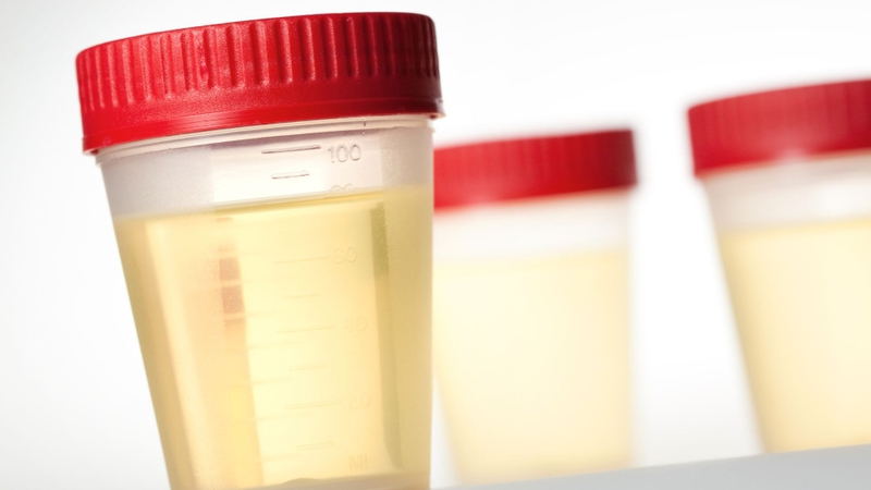 Pholcodine chủ yếu thải trừ qua nước tiểu