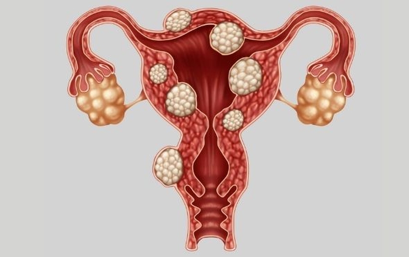 Phụ nữ trong khoảng thời gian rụng trứng có đau nhức, mỏi mệt hay không 4
