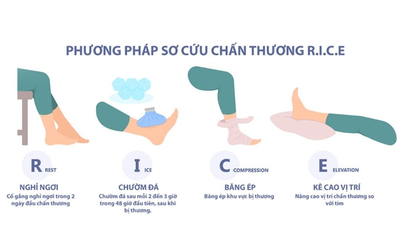 Phương pháp RICE là gì? Biện pháp sơ cứu chấn thương do thể thao hiệu quả 1