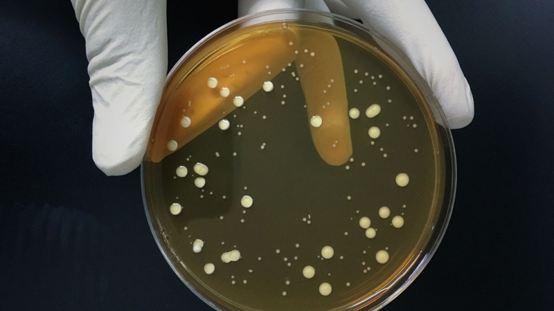 Pyrithione là hợp chất có hoạt tính sinh học mạnh, nổi bật với khả năng ức chế sự phát triển của vi sinh vật