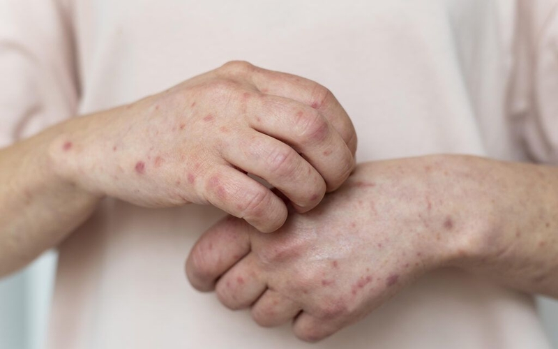 Quan hệ với nhiều người có bị HIV không? Tỷ lệ lây nhiễm HIV? 2