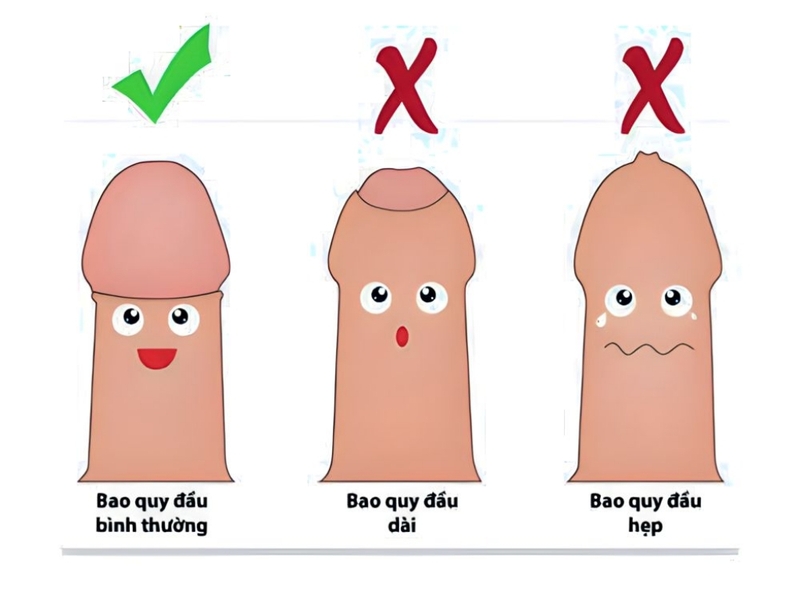 Quy trình cắt bao quy đầu và những điều cần lưu ý sau khi thực hiện thủ thuật 2