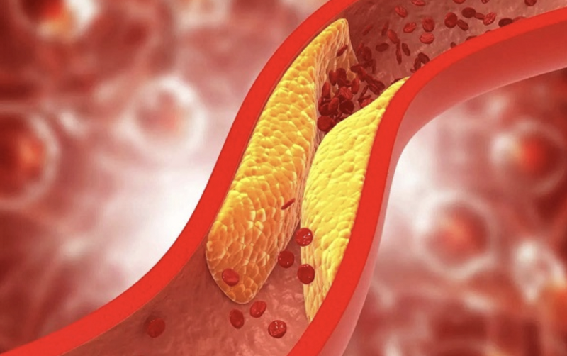 roi-loan-van-mach-nao-nguyen-nhan-cach-dieu-tri 3