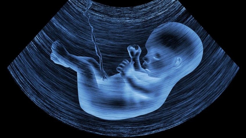 Siêu âm có phát hiện trẻ bị bại não hay không?3