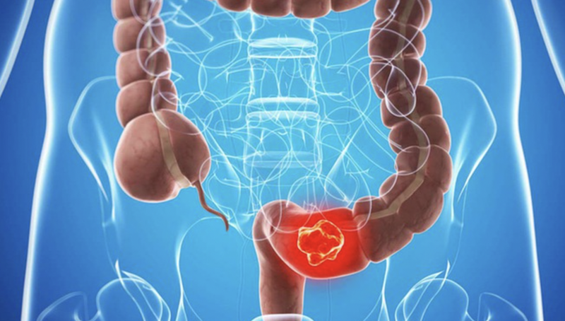 sinh-thiet-truc-trang-va-nhung-dieu-can-biet 2