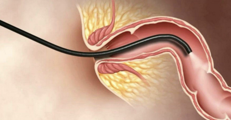 sinh-thiet-truc-trang-va-nhung-dieu-can-biet 3