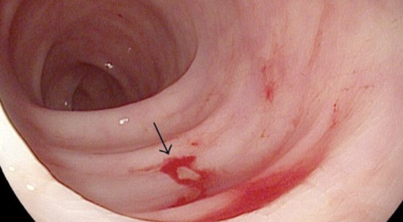 sinh-thiet-truc-trang-va-nhung-dieu-can-biet 4