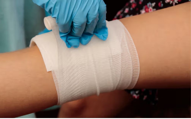 Sơ cứu vết thương chảy máu mao mạch và tĩnh mạch đúng cách, an toàn 3