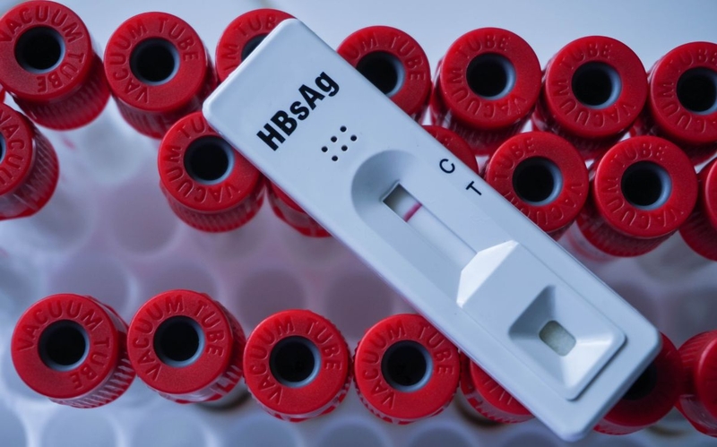 TD viêm gan là gì? Khi nào cần TD viêm gan 3