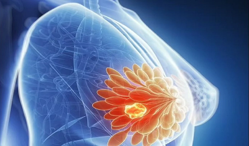 Tác hại của sữa đậu nành đối với nữ giới khi sử dụng quá nhiều 2