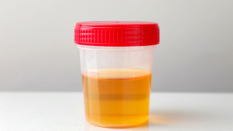 Sau khi được chuyển hóa, Testosterone chủ yếu được thải trừ qua thận dưới dạng nước tiểu