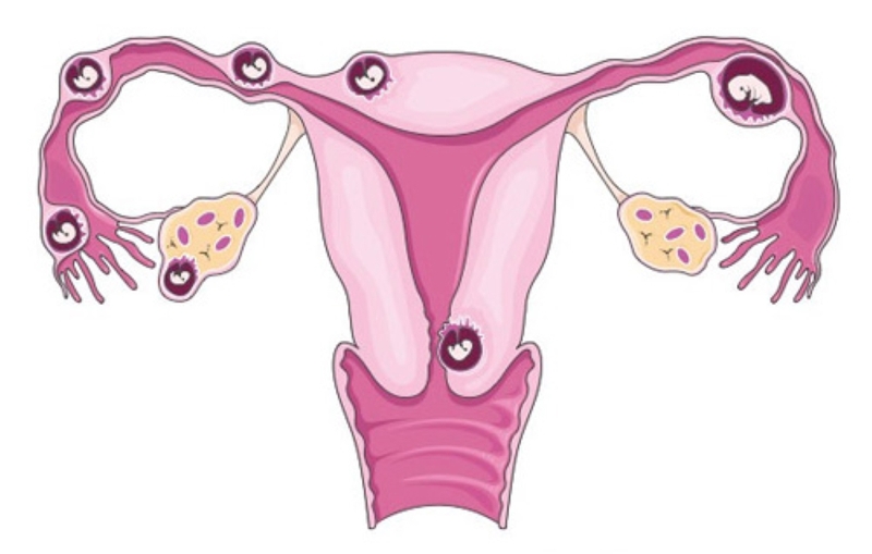 Thai 4 tuần đã vào tử cung chưa? Cần lưu ý gì khi mang thai tuần thứ 4? 2