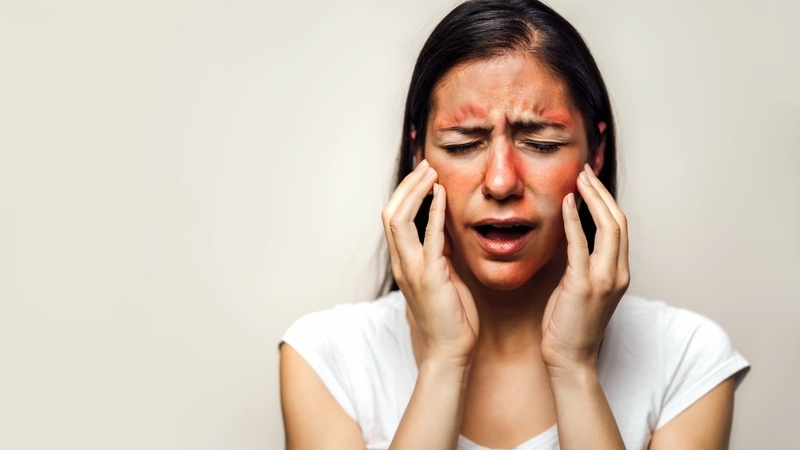 nguoi-benh-lupus-ban-do-he-thong-song-duoc-bao-lau-2