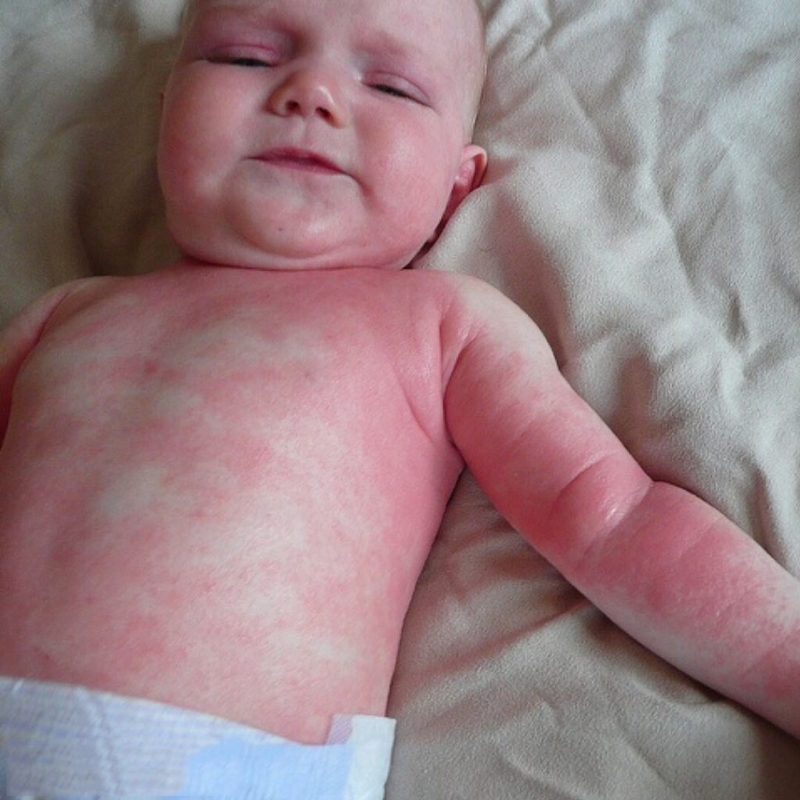 Thuốc Tobrex nhỏ mắt cho trẻ sơ sinh được không? 3