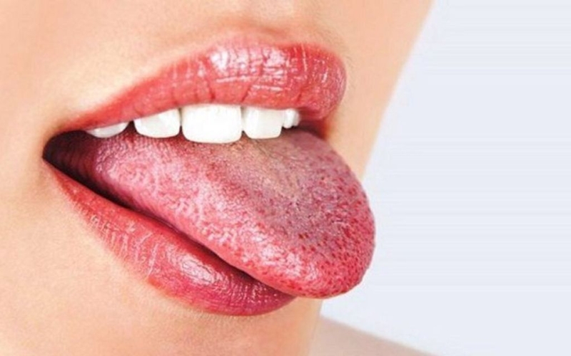 Thuốc Corticoid dạng hít là gì? Công dụng và lưu ý thận trọng khi sử dụng 3