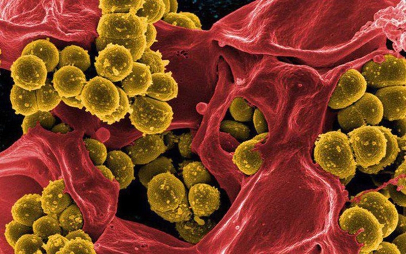 Thuốc kháng sinh chống viêm là gì? Những lưu ý khi sử dụng thuốc 1