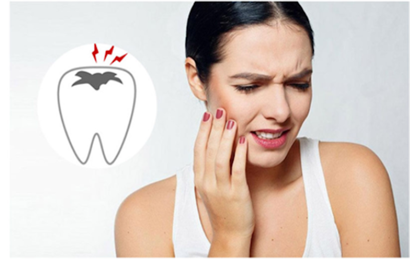 Thuốc kháng sinh điều trị viêm tuỷ răng 2.png