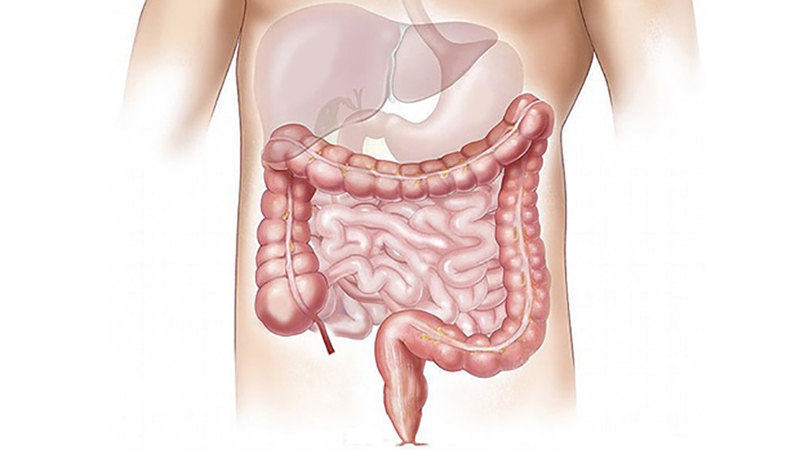 Thụt tháo đại tràng tại nhà - Tiềm ẩn nhiều rủi ro nguy hiểm 3