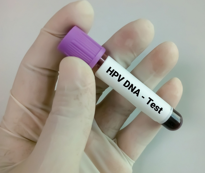 Tiền ung thư cổ tử cung: Nguyên nhân, triệu chứng, các phương pháp chẩn đoán và điều trị 4