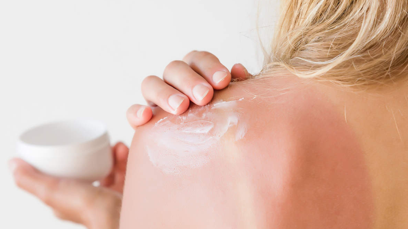 Tiết lộ một số cách chữa da cháy nắng bằng sữa chua 1