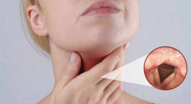 tim-hieu-ve-benh-ho-va-cac-loai-thuoc-giam-ho-hien-nay 4