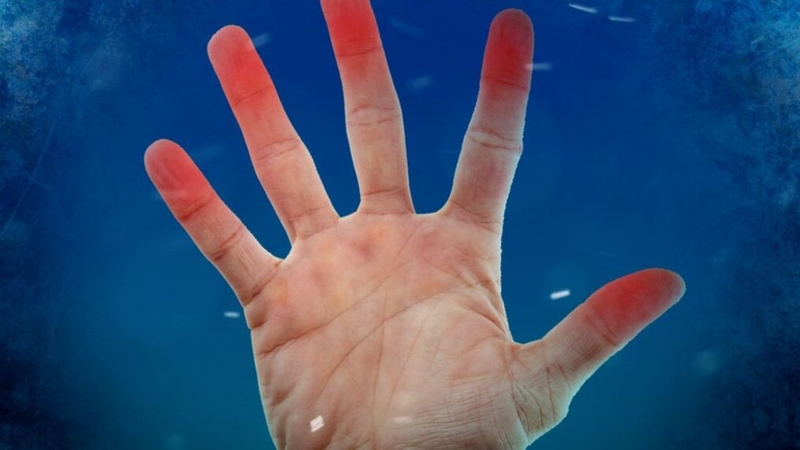 Tình trạng bỏng lạnh xảy ra phổ biến nhất ở ngón tay, ngón chân, mũi, tai, má và cằm 2