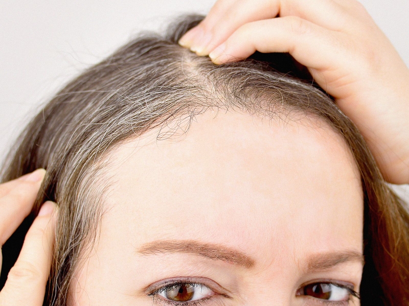 Tóc bạc sớm uống gì? Mách bạn những thức uống giúp mái tóc đen trở lại 1