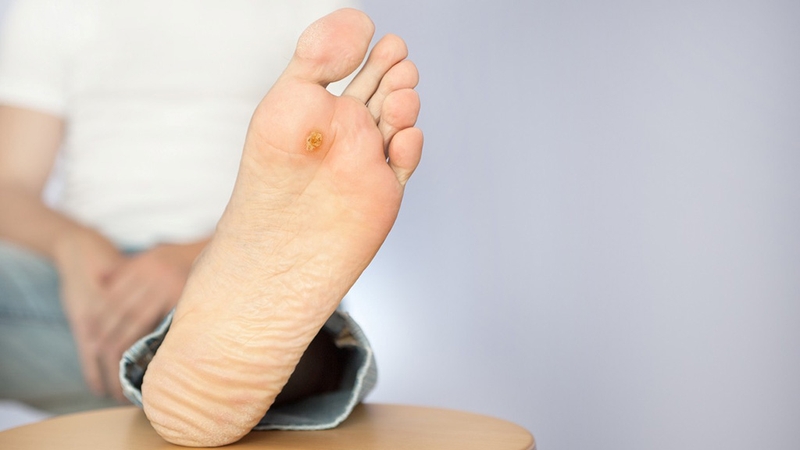 Tổng hợp những lời khuyên về việc chăm sóc da của người bị tiểu đường 2