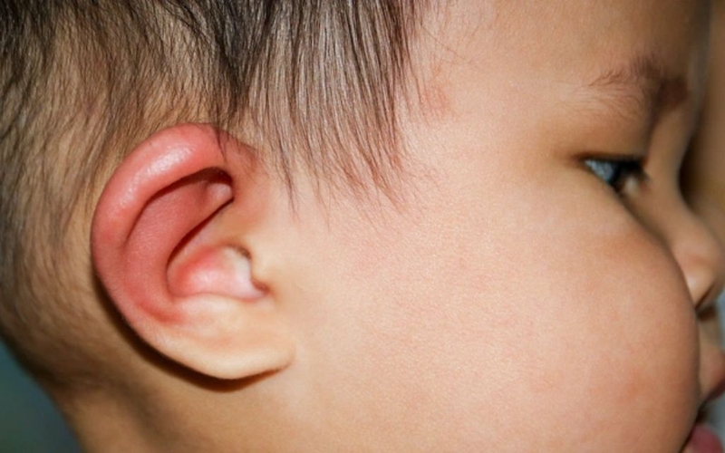 Trẻ 10 tháng tuổi bị nổi hạch sau tai có nguy hiểm không? Nguyên nhân do đâu 1
