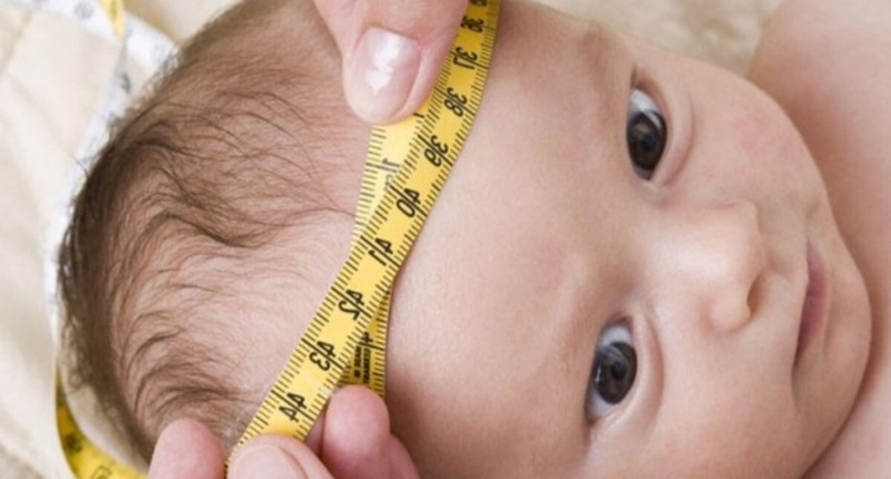 Trẻ bị não úng thủy sống được bao lâu? Nguyên nhân, triệu chứng và cách điều trị 3