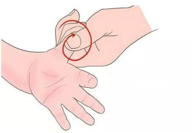 Trẻ sơ sinh có gân xanh ở sống mũi có sao không? 4.png