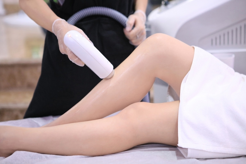 Triệt lông chân giá bao nhiêu khi sử dụng triệt lông Laser? 1