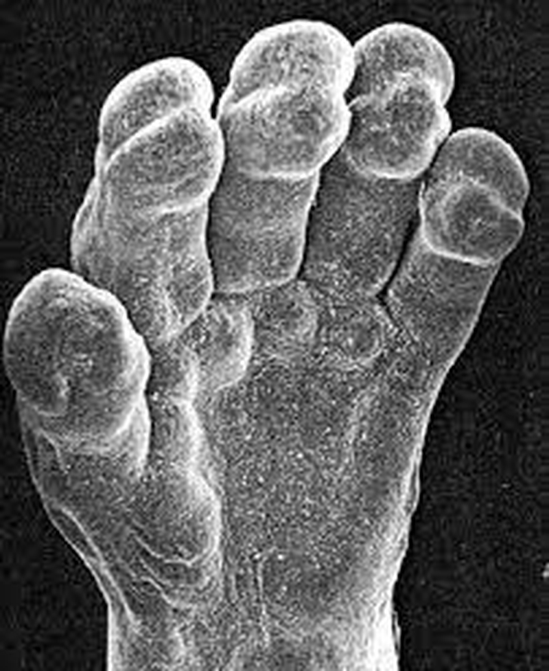 Trong khoảng thời gian thai nhi được 6-7 tuần, thai nhi bắt đầu có miếng đệm dày ở lòng bàn tay và bàn chân 2