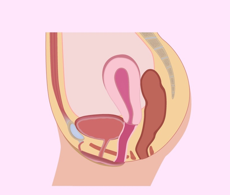 Tử cung ngả sau có xu hướng dính vào trực tràng 1