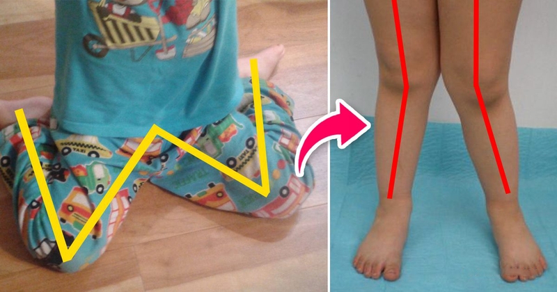 Tư thế này có thể gây ra các vấn đề về dáng người 1