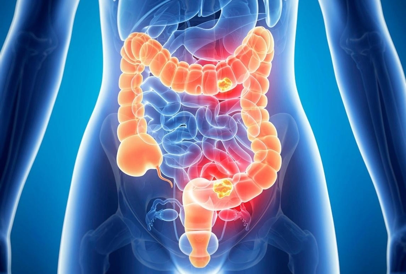 Tự ý thụt tháo đại tràng có tốt không 2