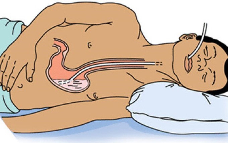 Tuân thủ các cách xử lý khi ngộ độc paracetamol để người bệnh hồi phục nhanh chóng 1