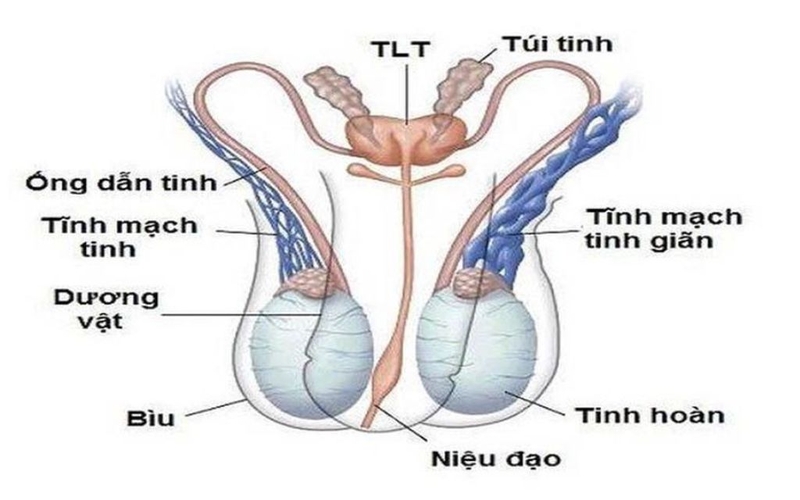 Túi giãn tĩnh mạch bìu là gì? Nguyên nhân và phương pháp điều trị 1