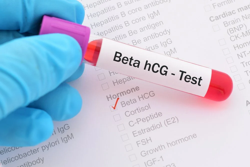 Túi thai 10mm chưa có phôi thai có sao không? 3