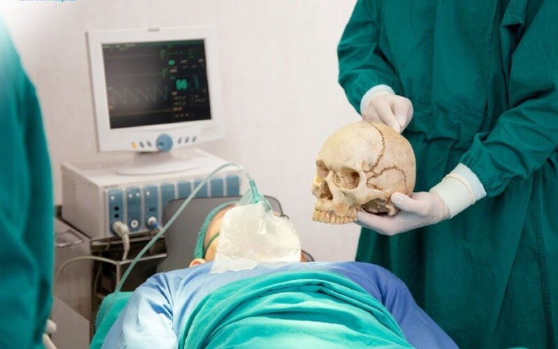 U màng não có nên mổ không? Chi phí và biến chứng sau phẫu thuật 4