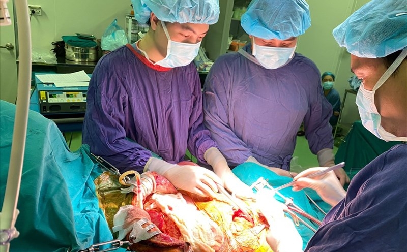 Phẫu thuật loại bỏ các khối u máu gan