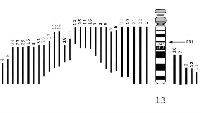 Ung thư nguyên bào võng mạc 7.jpg