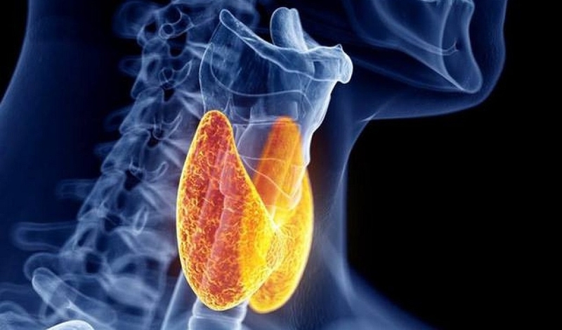 Ung thư tuyến giáp giai đoạn 3 sống được bao lâu? Cách chăm sóc người bệnh ung thư tuyến giáp 4